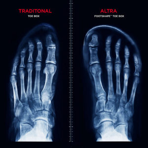 altra toe box